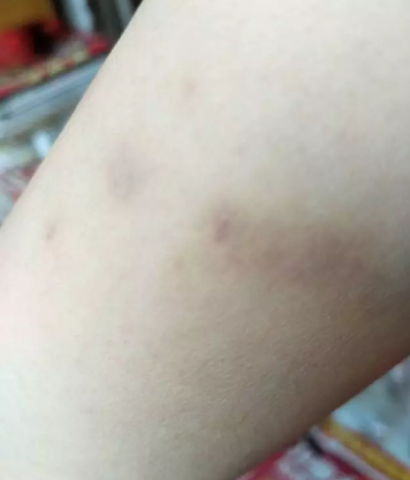 092333lh1upb5r113p5num.png.thumb.jpg