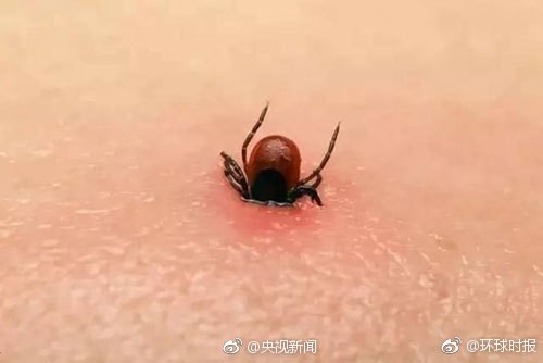 160814d54be46rqr5zpzii.jpg.thumb.jpg