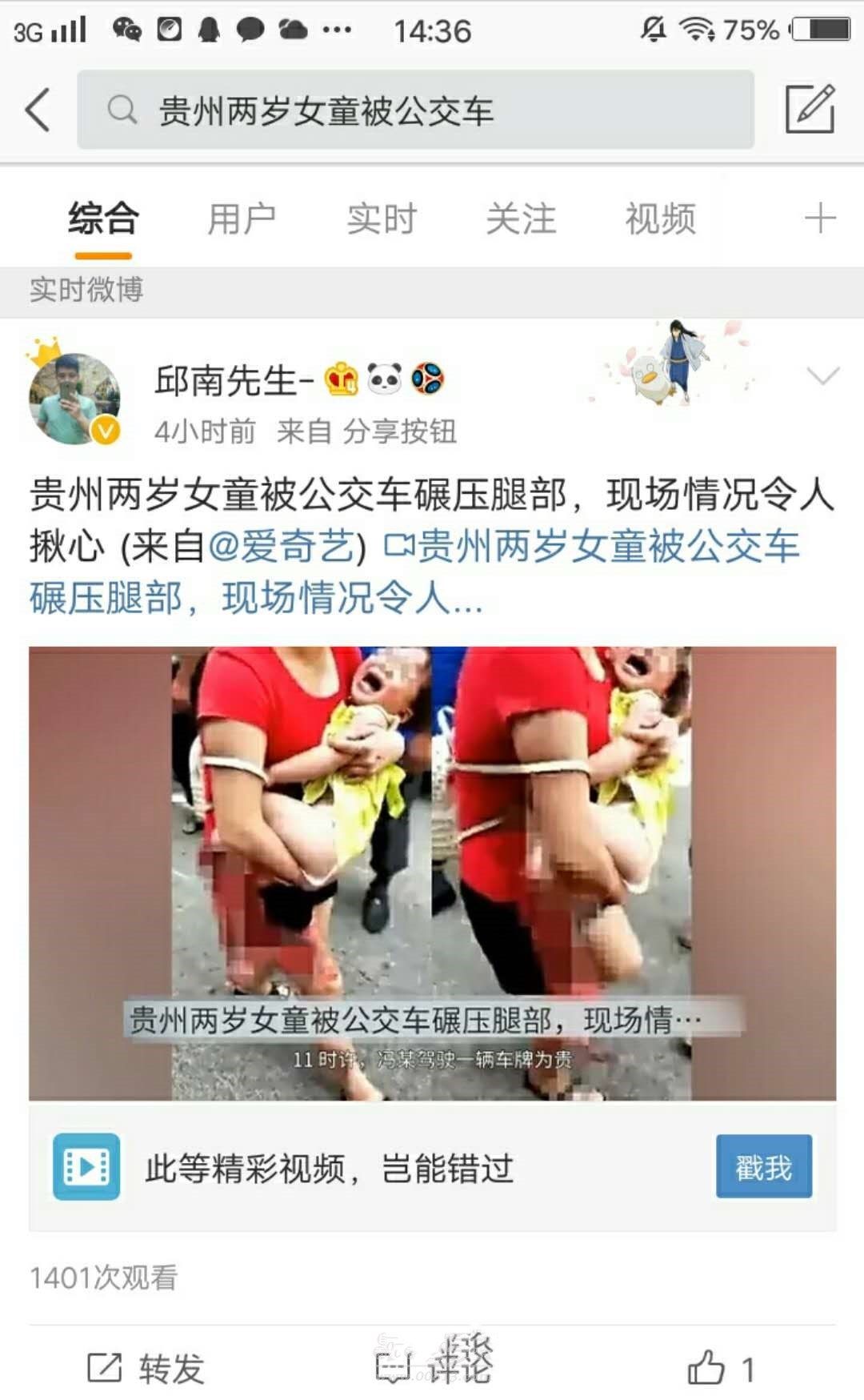 辟谣！网传自贡发生恶犬咬断女孩的腿？真相其实是这样...
