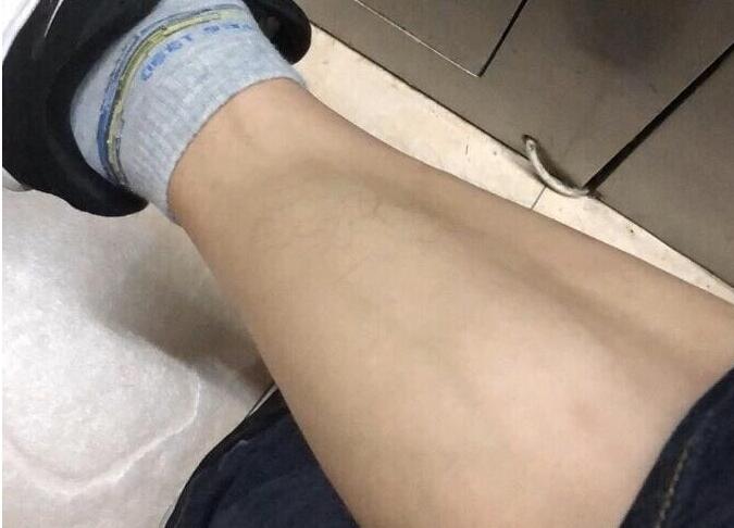 男同事居然没腿毛，比我还白净，一对比真的很生气-1.jpg