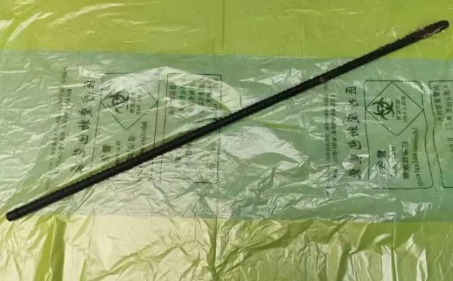 自贡四医院多科合作，从小哥身体取出约一米长贯穿臀部的钢筋-5.jpg
