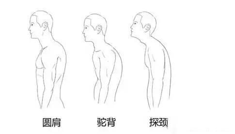 90%上班族普遍存在的现象 别以为是驼背-1.jpg