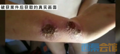 警惕！缅北究竟是什么地方？富顺一女子告诉你-4.png