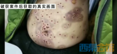 警惕！缅北究竟是什么地方？富顺一女子告诉你-6.png