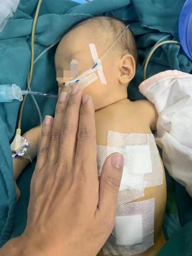 自贡一医院成功为一出生33天婴儿完成幽门环肌切开手术-2.jpg