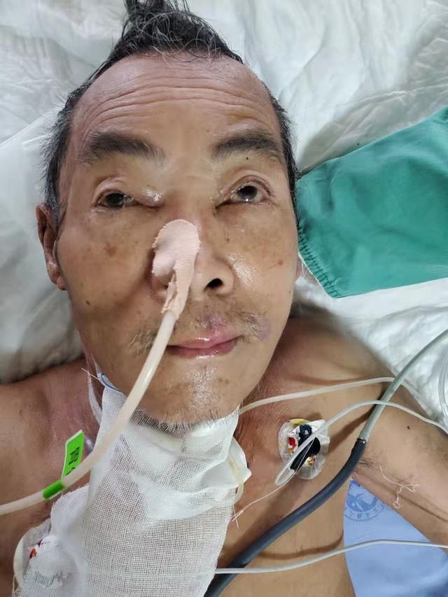 五旬男子在自贡遭遇车祸被送医，现重度昏迷，急寻亲人-1.jpg
