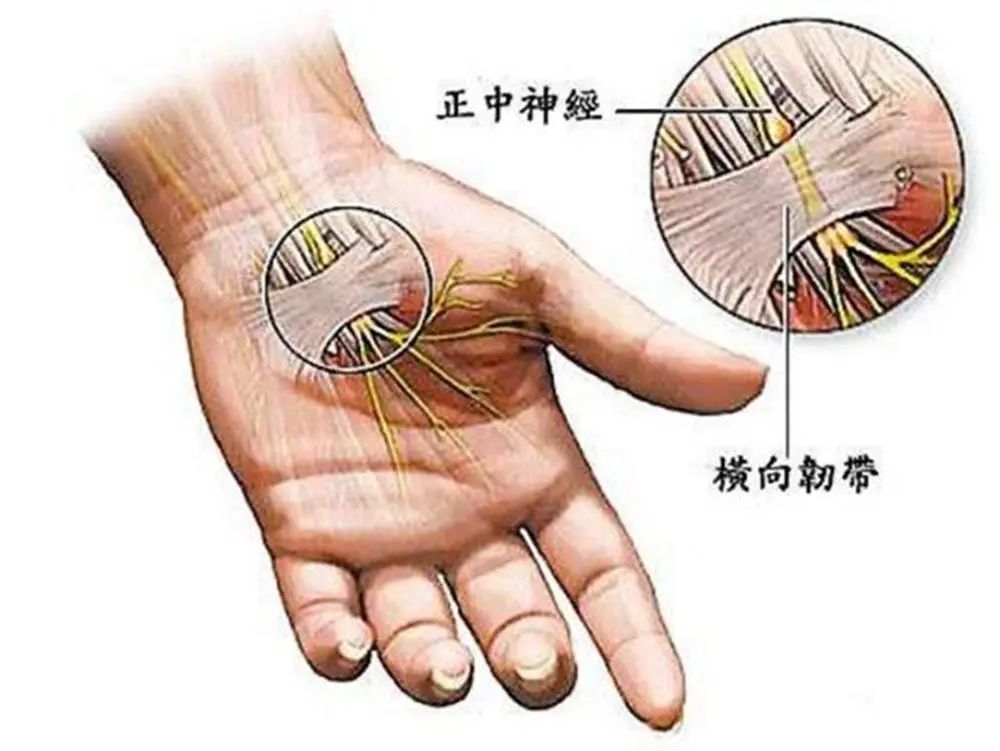 经常用电脑的人注意！严重可导致肌肉萎缩 ！ “鼠标手”判断和预防方法了解下→-1.jpg