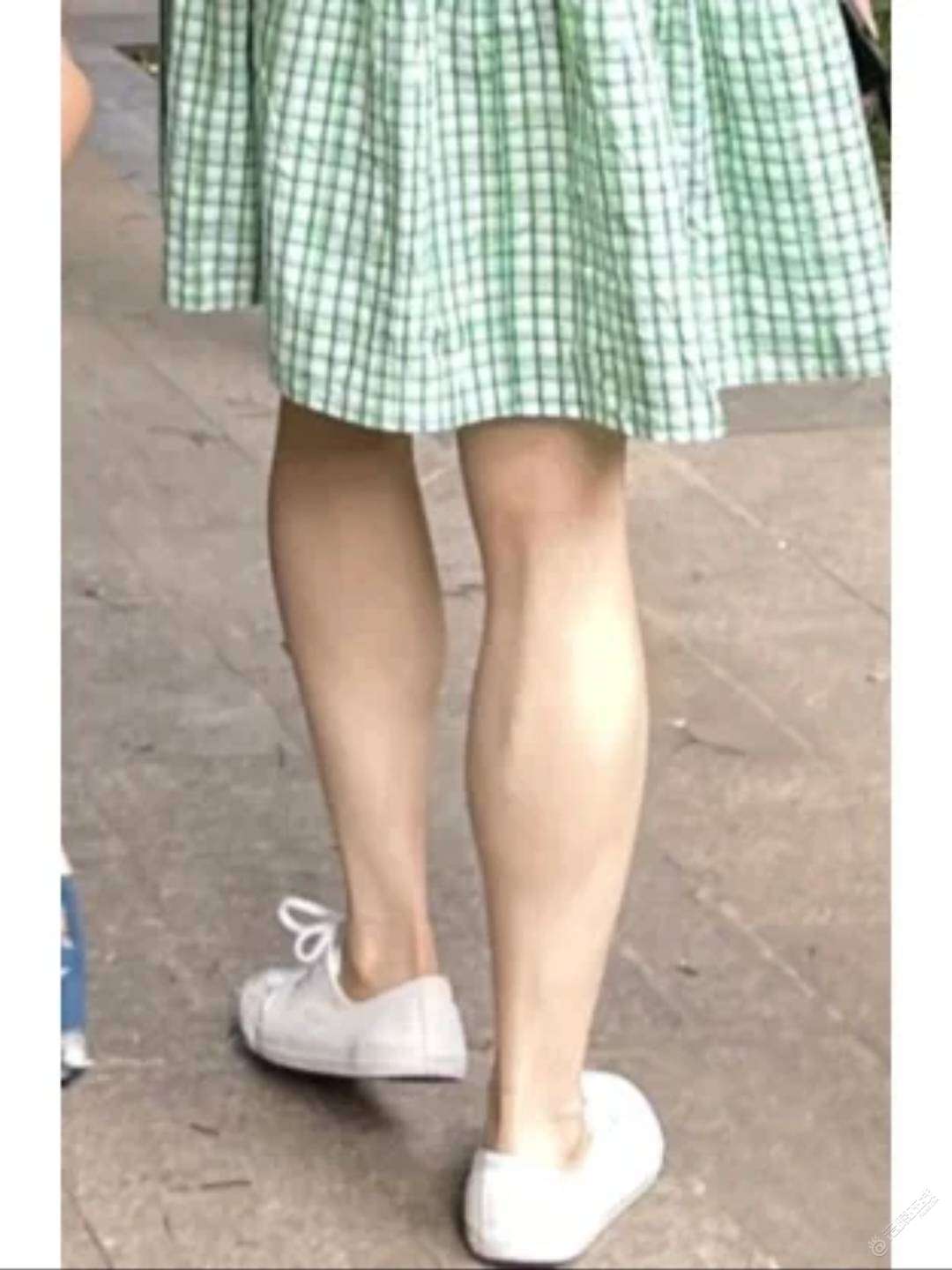 救命！这种腿还有救吗？工作服又是短裙，但真的没有勇气穿-1.jpg