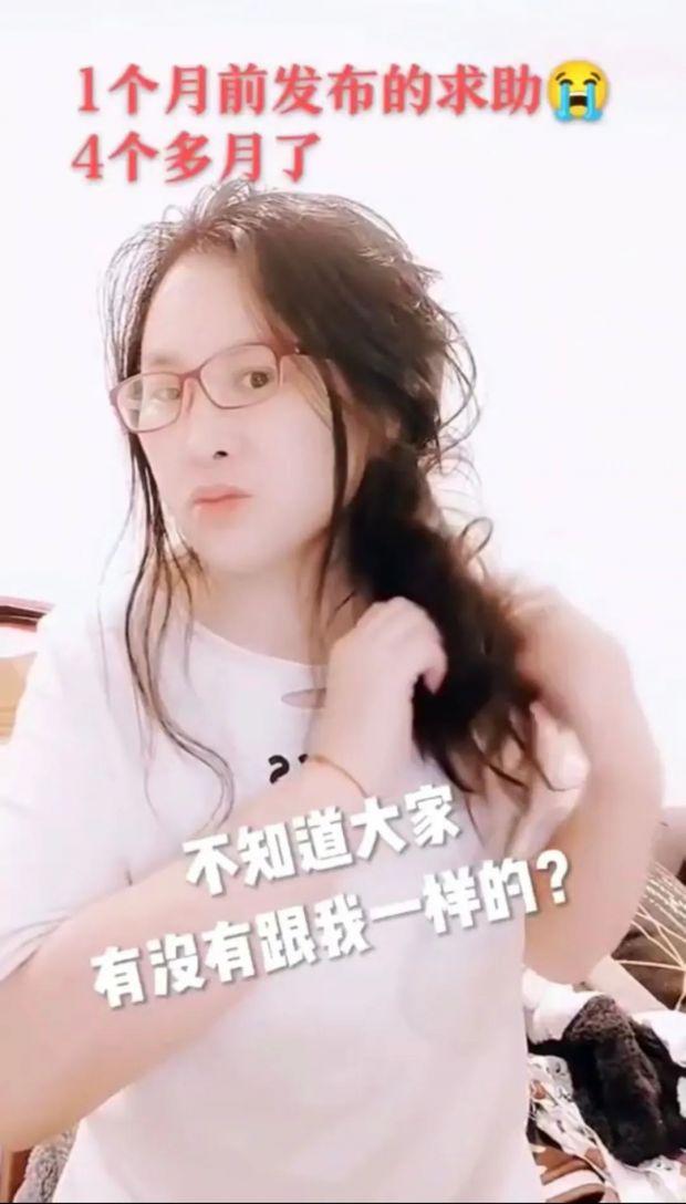 神操作！女子怕头秃3个月不洗头，结果悲剧了……如今全网求助-1.jpg