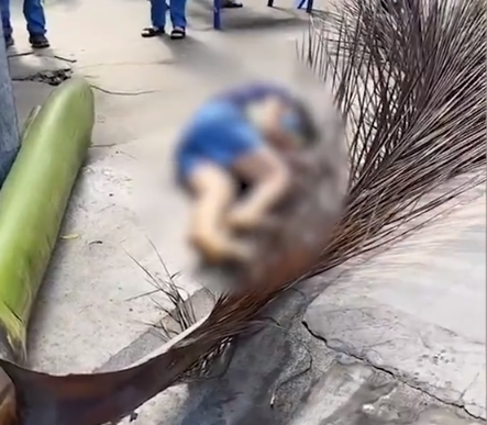 路人被椰子树叶砸倒颅内积血 情况比较严重-1.png