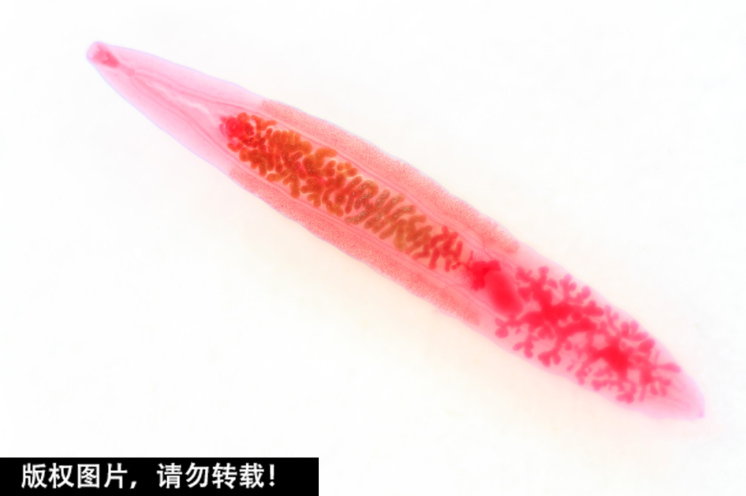 @自贡家长：6岁男童患上"肝吸虫病"，致病元凶竟是它！家家都有…-4.png