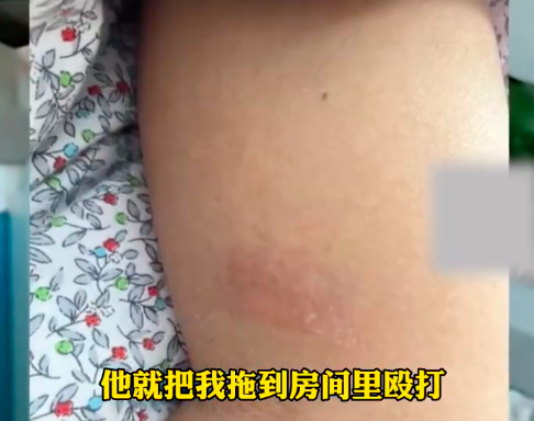 女子因在家里看街舞综艺被丈夫殴打，当事女子：他很讨厌跳街舞的，目前已报警-5.jpg