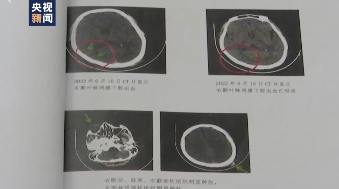 唐山打人案“保护伞”被查现场曝光，省公安厅副厅长：对害群之马绝不姑息-2.jpg