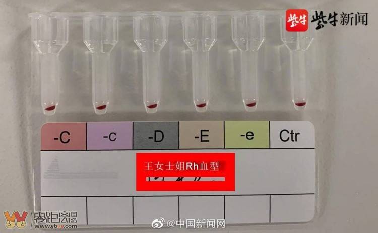 江苏发现2例罕见黄金血型，全球不足50例！-1.jpg