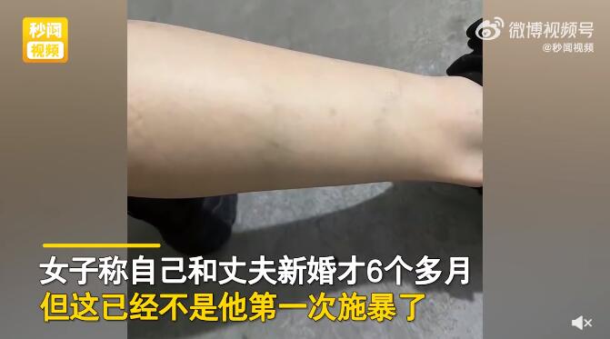 远嫁女子孕期遭家暴娘家上门接回家-2.jpg