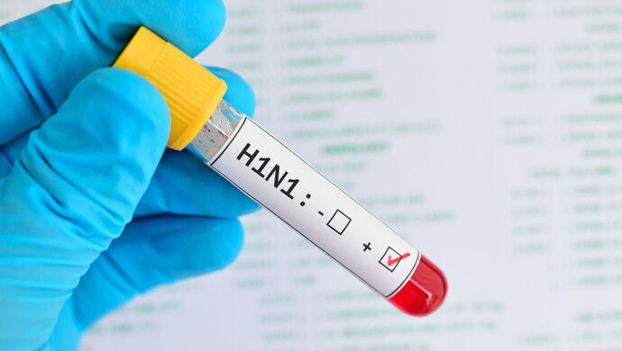 俄罗斯全境均出现甲型H1N1！什么症状？-1.jpeg