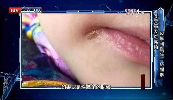 比久坐更伤身！7个常见坏习惯，你可能每天都在做-1.jpg