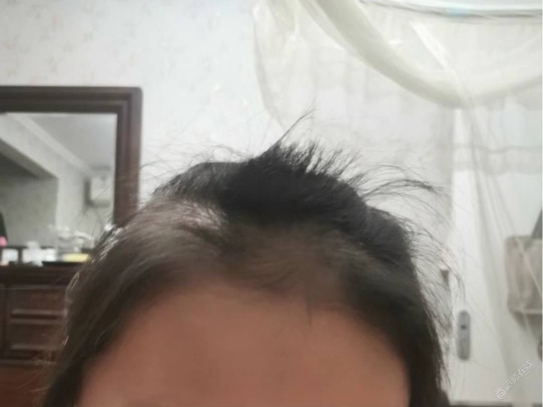 小侄女自己把自己头发剪成这样了，还有救吗？-1.jpg