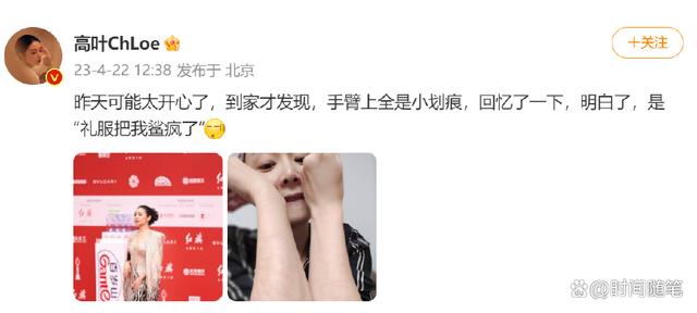 美丽的代价！高叶晒满是划痕的手臂，自侃被礼服鲨疯了-1.jpg