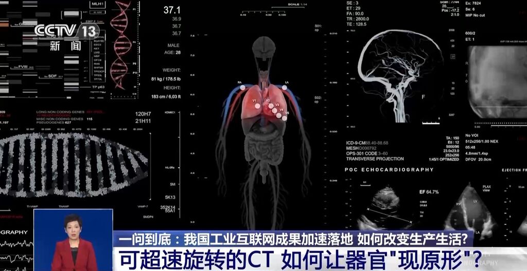 人体器官可以拿在手上？一起去全球工业互联网大会看看这些新技术→-2.jpg