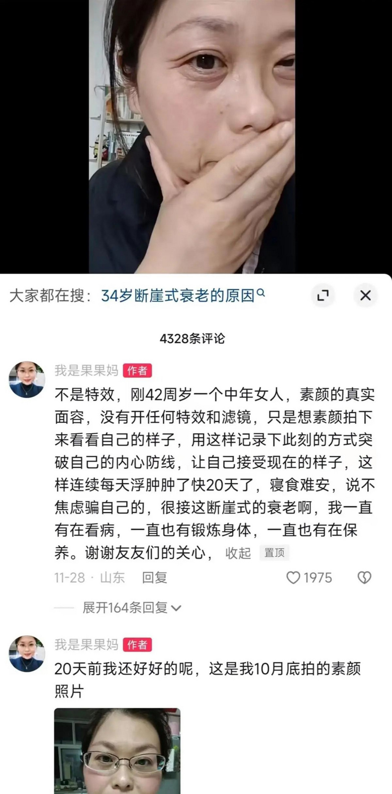 “20天老了三十多岁”！42岁女子经历断崖式衰老-2.jpg