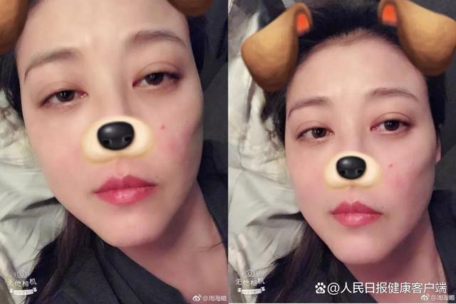 演员周海媚因病去世！红斑狼疮被称为“不死的癌症”，偏爱女性-2.jpg