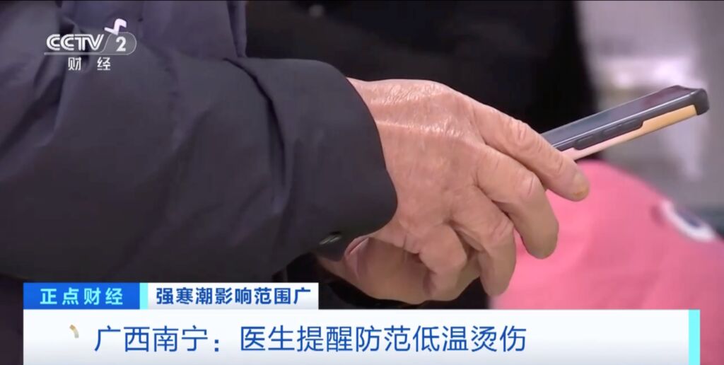 冬季警惕发生低温烫伤！医生提醒：不要通宵使用电热毯-3.jpg