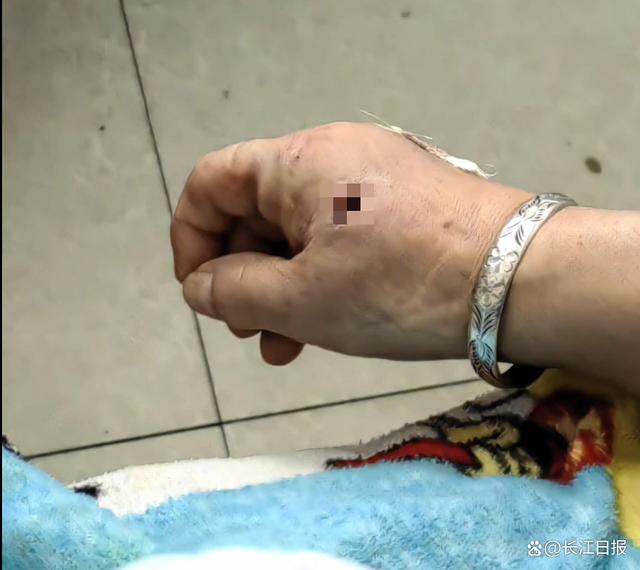 哈尔滨一遛狗女子遭大黑狗扑咬，家属称狗主人不道歉赔偿，派出所：会规范处理-2.jpg