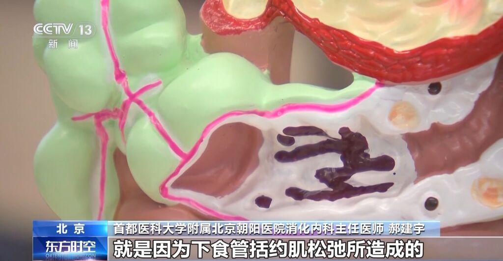 春节聚餐小心别伤胃 这些护胃知识要记牢→-3.jpg
