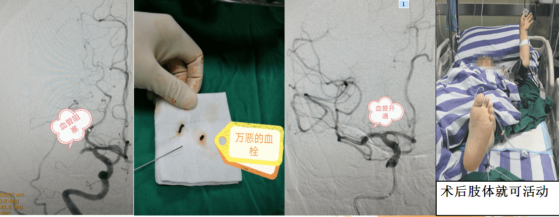自贡市第一人民医院神经内科简介-8.png
