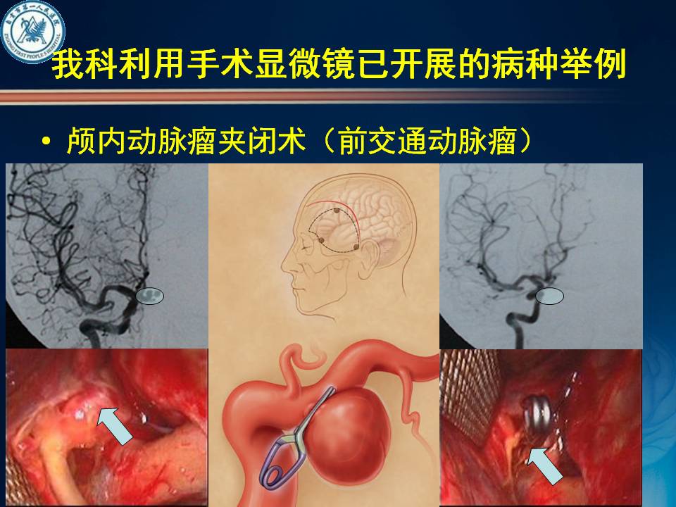 自贡市第一人民医院神经外科简介-2.jpg
