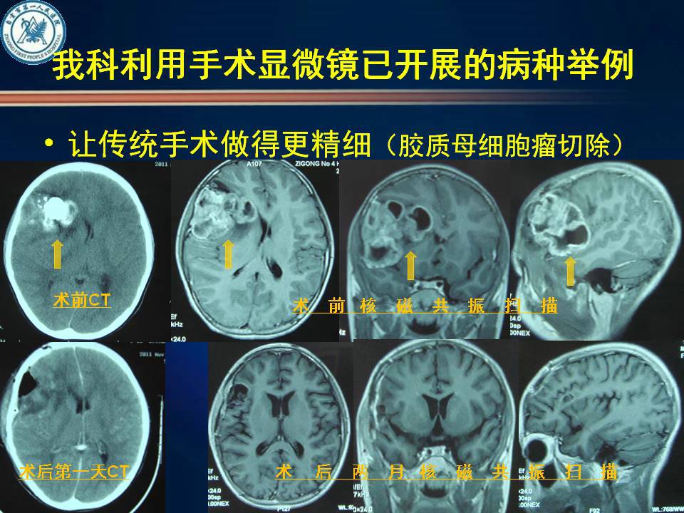 自贡市第一人民医院神经外科简介-7.jpg