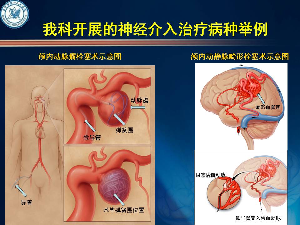 自贡市第一人民医院神经外科简介-9.jpg