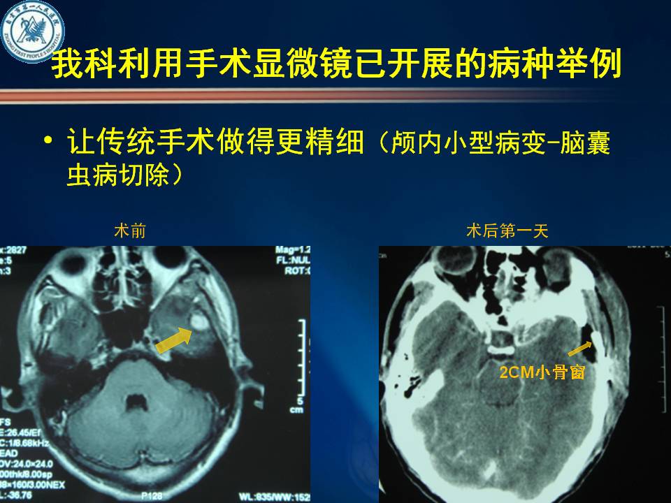 自贡市第一人民医院神经外科简介-5.jpg