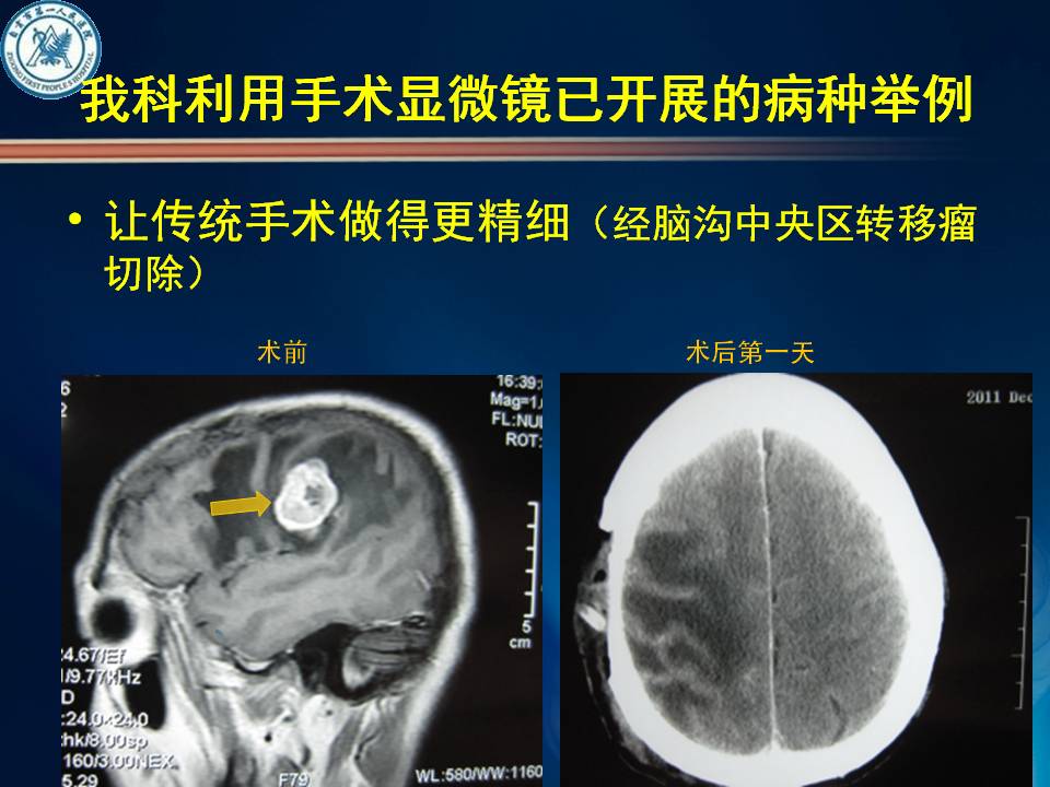 自贡市第一人民医院神经外科简介-6.jpg
