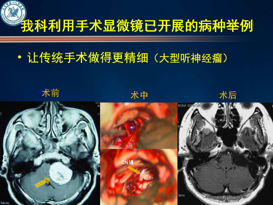 自贡市第一人民医院神经外科简介-4.jpg