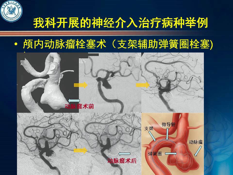 自贡市第一人民医院神经外科简介-10.jpg