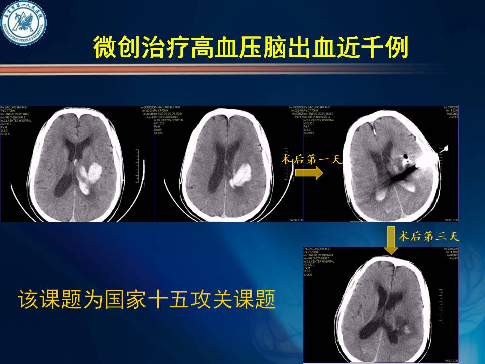 自贡市第一人民医院神经外科简介-11.jpg