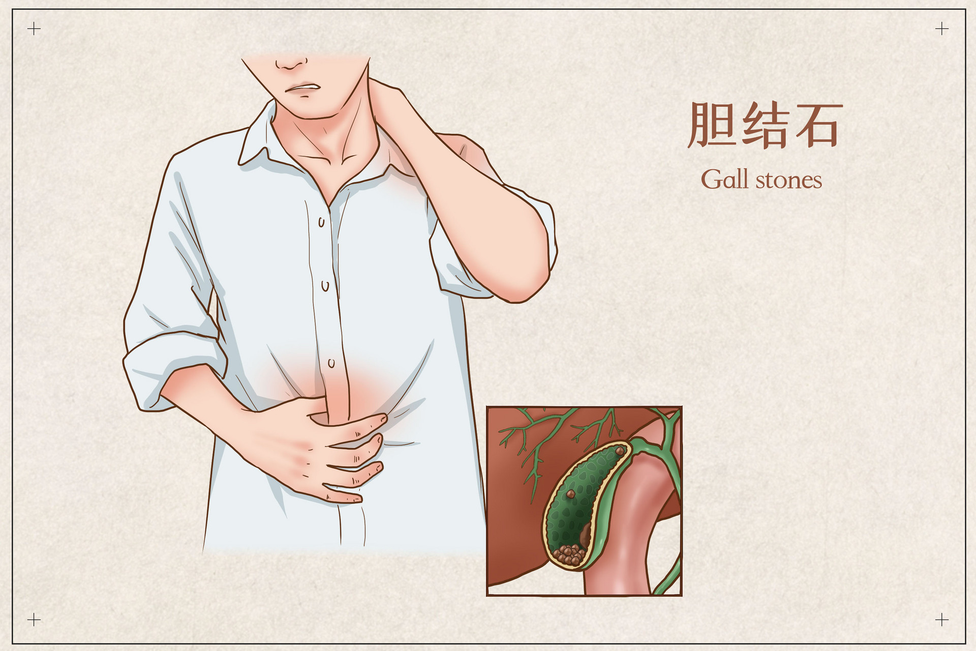不吃早餐，真的会胆结石吗？-2.jpg