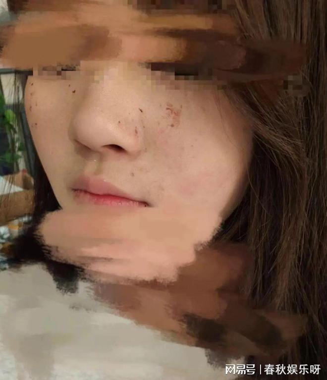 俩16岁女生拒绝男子陪酒要求, 被打得满脸是血-2.jpg