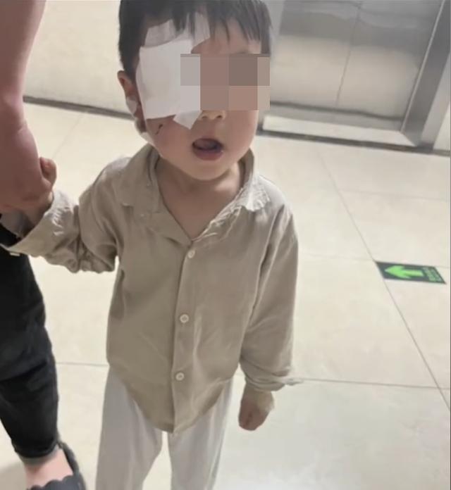 3岁男童被狗咬伤18天后离世，狗仍去向不明？当地回应橙柿：警方已提级调查-4.jpg