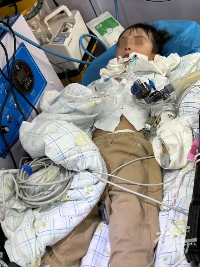 3岁男童被狗咬伤18天后离世，狗仍去向不明？当地回应橙柿：警方已提级调查-1.jpg