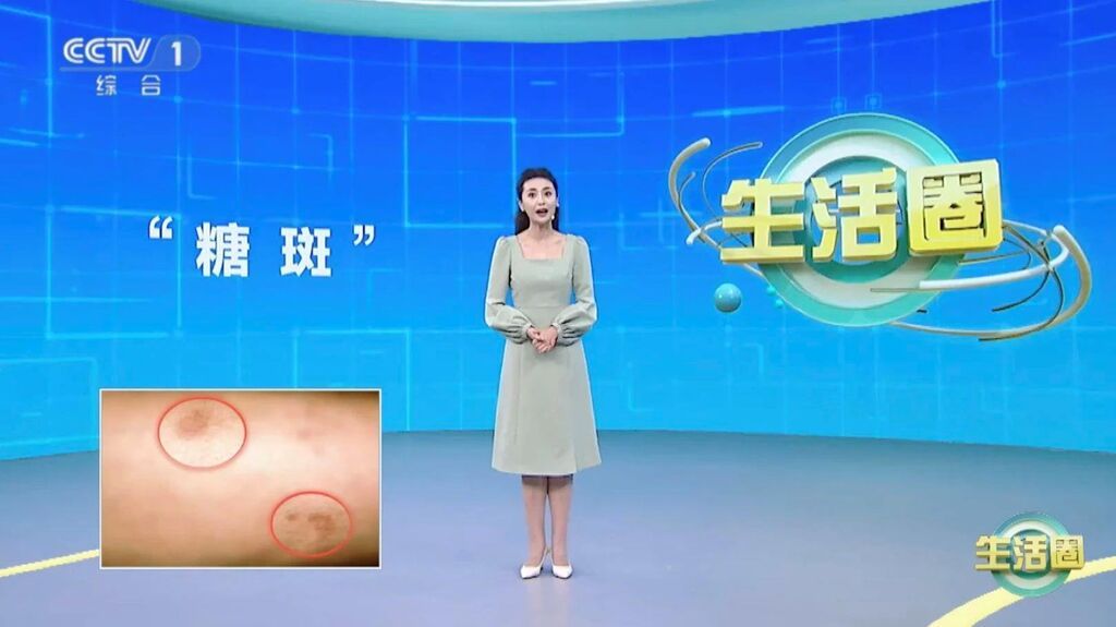 人体自带“血糖仪” 这些变化提示你血糖可能异常了-1.jpg