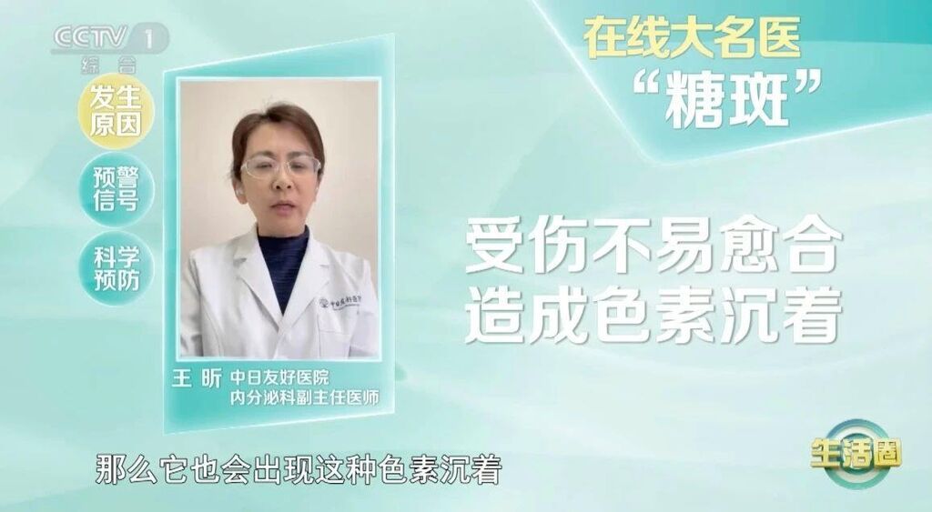 人体自带“血糖仪” 这些变化提示你血糖可能异常了-3.jpg