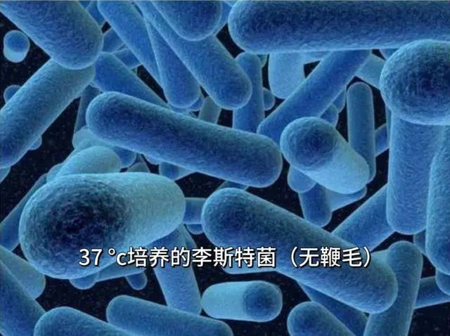 一杯下肚，孕妈感染，宝宝早产休克！严重可致死，很多人却疏忽了-2.jpg