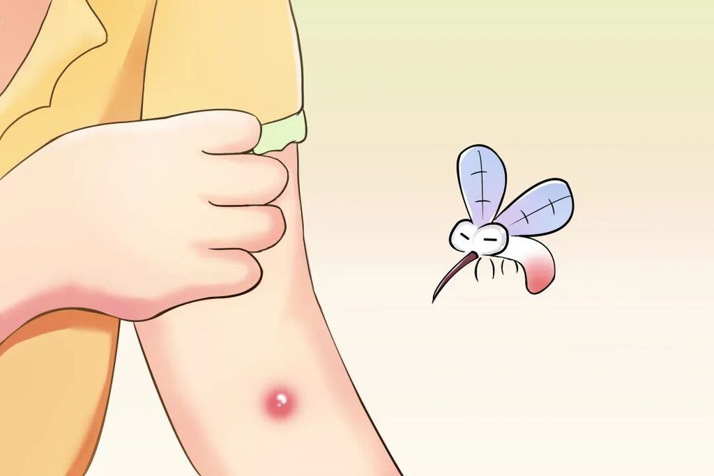 蚊叮虫咬后的“红疙瘩”，这样处理好得快-1.jpg