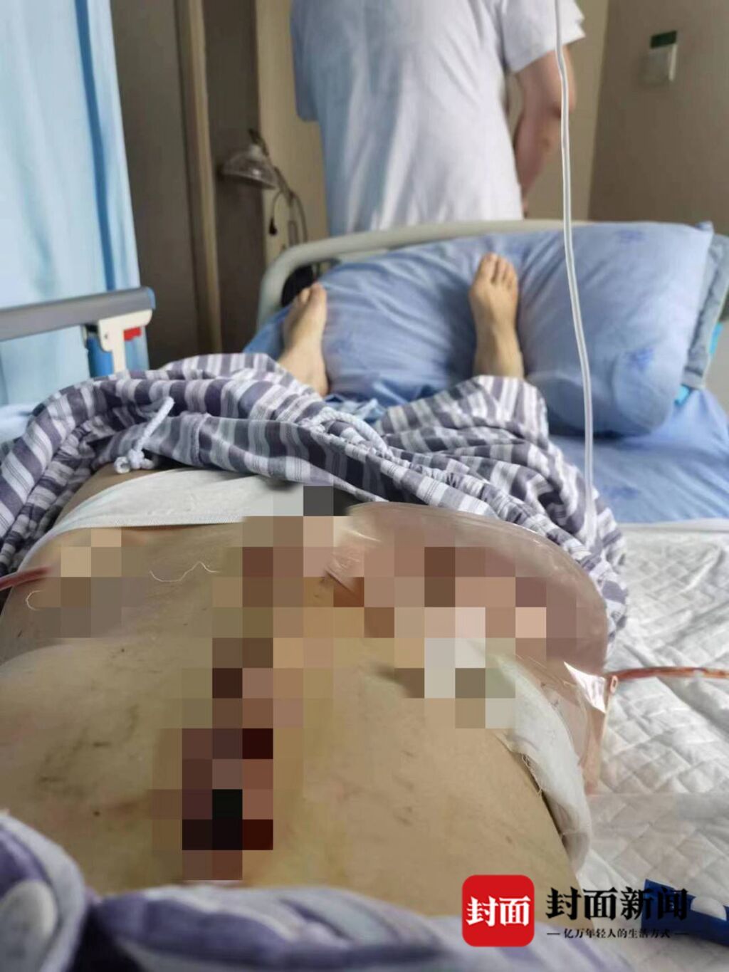 遭家暴16次需终身挂粪袋女子：希望将前夫罪名改为“故意杀人罪”-3.jpg