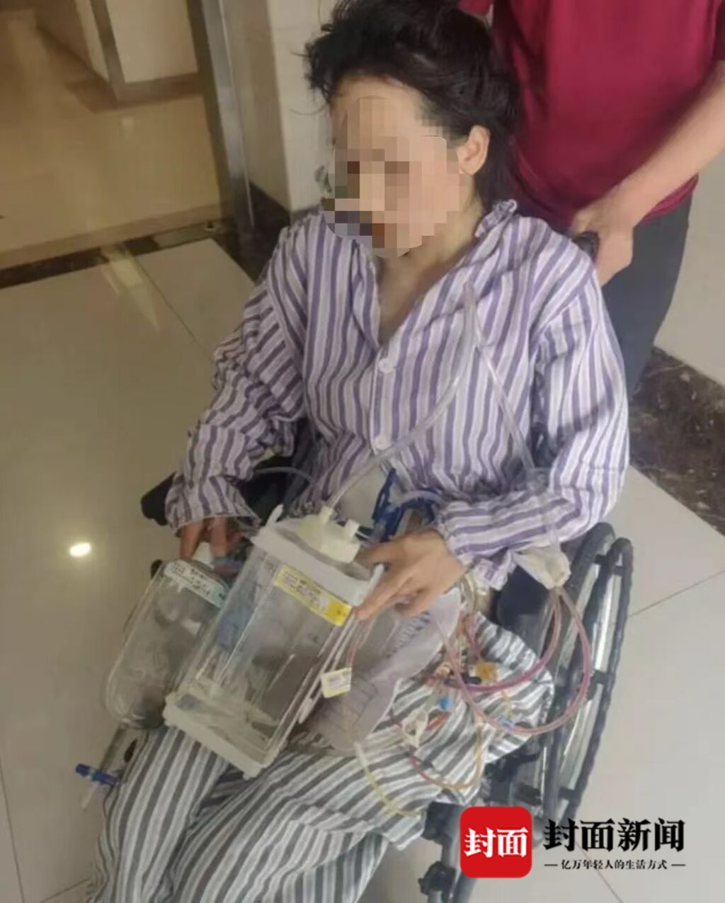 遭家暴16次需终身挂粪袋女子：希望将前夫罪名改为“故意杀人罪”-1.jpg