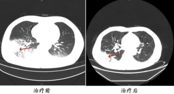 3天空调吹出“白肺”！高温来了，这个细节要当心-4.jpg