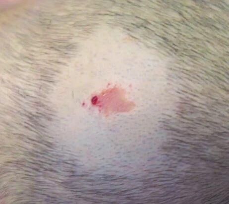 头上的痣暗藏癌变风险？出现这3种情况一定要警惕-1.jpg